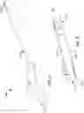 Fig. 02 - Surgical devices and methods