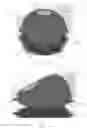 Fig. 02 - Tissue expanders having integrated drainage and infusion assemblies
