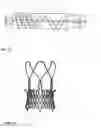 Fig. 07 - Catheter delivery system for stent valve