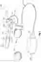 Fig. 02 - Expandable penile prosthesis