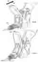 Fig. 23 - Device and method for creating a channel in soft tissue