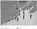 Fig. 02 - Intraocular device for dual incisions