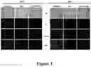 Fig. 02 - Multiresistant-tumour sensitiser