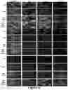 Fig. 07 - Multiresistant-tumour sensitiser