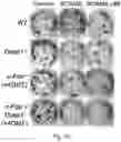 Fig. 38 - THERAPY FOR KINASE-DEPENDENT MALIGNANCIES