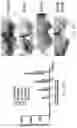 Fig. 94 - THERAPY FOR KINASE-DEPENDENT MALIGNANCIES
