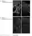 Fig. 04 - METHODS AND PHARMACEUTICAL COMPOSITIONS FOR THE TREATMENT OF OLMSTED SYNDROME