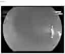 Fig. 02 - SOLID ORAL COMPOSITION CONTAINING DYES FOR USE IN ENDOSCOPIC DIAGNOSIS