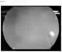 Fig. 03 - SOLID ORAL COMPOSITION CONTAINING DYES FOR USE IN ENDOSCOPIC DIAGNOSIS