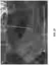 Fig. 32 - BIORESORBABLE MAGNESIUM-BASED SPONGE AND FOAM MATERIALS, METHODS AND DEVICES
