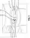 Fig. 02 - Dual Therapy Device and Related Method