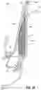 Fig. 13 - Vacuum driven suction and irrigation system