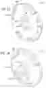 Fig. 08 - Adjustable dumbbell system