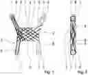 Fig. 02 - Four-point link