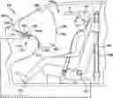 Fig. 01 - Airbag with notched deployment controlling flap