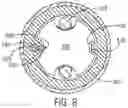 Fig. 08 - Retractable cord management system