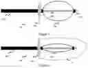 Fig. 02 - Occlusion systems