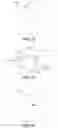 Fig. 08 - Apparatus for creating incisions to improve intraocular lens placement