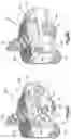 Fig. 09 - Zero-profile interbody spacer and coupled plate assembly