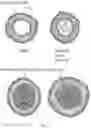 Fig. 02 - Methods and compositions for natural killer cells
