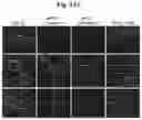 Fig. 20 - Reducing systemic regulatory T cell levels or activity for treatment of a retinal degeneration disorder