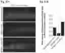 Fig. 30 - Reducing systemic regulatory T cell levels or activity for treatment of a retinal degeneration disorder
