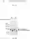Fig. 04 - Multivalent glycopeptides that tightly bind to target proteins
