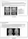 Fig. 366 - Methods and systems for preventing, correcting, transforming, and modifying facial, aesthetics, and consulting patients regarding the same