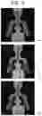 Fig. 06 - SIMULATOR, INJECTION DEVICE OR IMAGING SYSTEM PROVIDED WITH SIMULATOR, AND SIMULATION PROGRAM