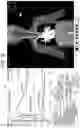 Fig. 07 - SIMULATOR, INJECTION DEVICE OR IMAGING SYSTEM PROVIDED WITH SIMULATOR, AND SIMULATION PROGRAM