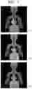 Fig. 08 - SIMULATOR, INJECTION DEVICE OR IMAGING SYSTEM PROVIDED WITH SIMULATOR, AND SIMULATION PROGRAM