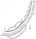 Fig. 06 - Endotracheal tube system and method