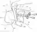 Fig. 01 - Wrap systems for medical device kits