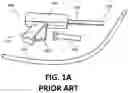 Fig. 02 - Sutureless adhesion system