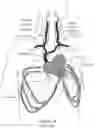 Fig. 02 - Transvascular nerve stimulation apparatus and methods