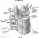Fig. 63 - METHOD AND APPARATUS FOR CLOSING A FISSURE IN THE ANNULUS OF AN INTERVERTEBRAL DISC, AND/OR FOR EFFECTING OTHER ANATOMICAL REPAIRS AND/OR FIXATIONS