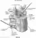 Fig. 64 - METHOD AND APPARATUS FOR CLOSING A FISSURE IN THE ANNULUS OF AN INTERVERTEBRAL DISC, AND/OR FOR EFFECTING OTHER ANATOMICAL REPAIRS AND/OR FIXATIONS