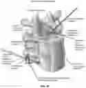 Fig. 65 - METHOD AND APPARATUS FOR CLOSING A FISSURE IN THE ANNULUS OF AN INTERVERTEBRAL DISC, AND/OR FOR EFFECTING OTHER ANATOMICAL REPAIRS AND/OR FIXATIONS