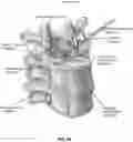 Fig. 67 - METHOD AND APPARATUS FOR CLOSING A FISSURE IN THE ANNULUS OF AN INTERVERTEBRAL DISC, AND/OR FOR EFFECTING OTHER ANATOMICAL REPAIRS AND/OR FIXATIONS