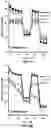 Fig. 07 - Mitoketoscins: mitochondrial-based therapeutics targeting ketone metabolism in cancer cells