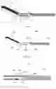 Fig. 07 - Atherectomy device and method