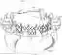 Fig. 01 - Replacement mitral valves