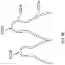Fig. 07 - Replacement mitral valves