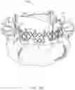 Fig. 28 - Replacement mitral valves