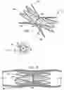 Fig. 02 - Vascular implant