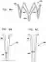 Fig. 08 - Vascular implant