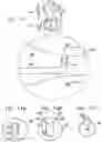 Fig. 10 - Vascular implant
