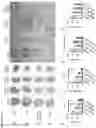 Fig. 09 - Engineered anthrax protective antigen proteins for cancer therapy