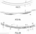 Fig. 03 - Hollow plastic article