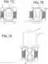 Fig. 10 - Surface-mountable locking device